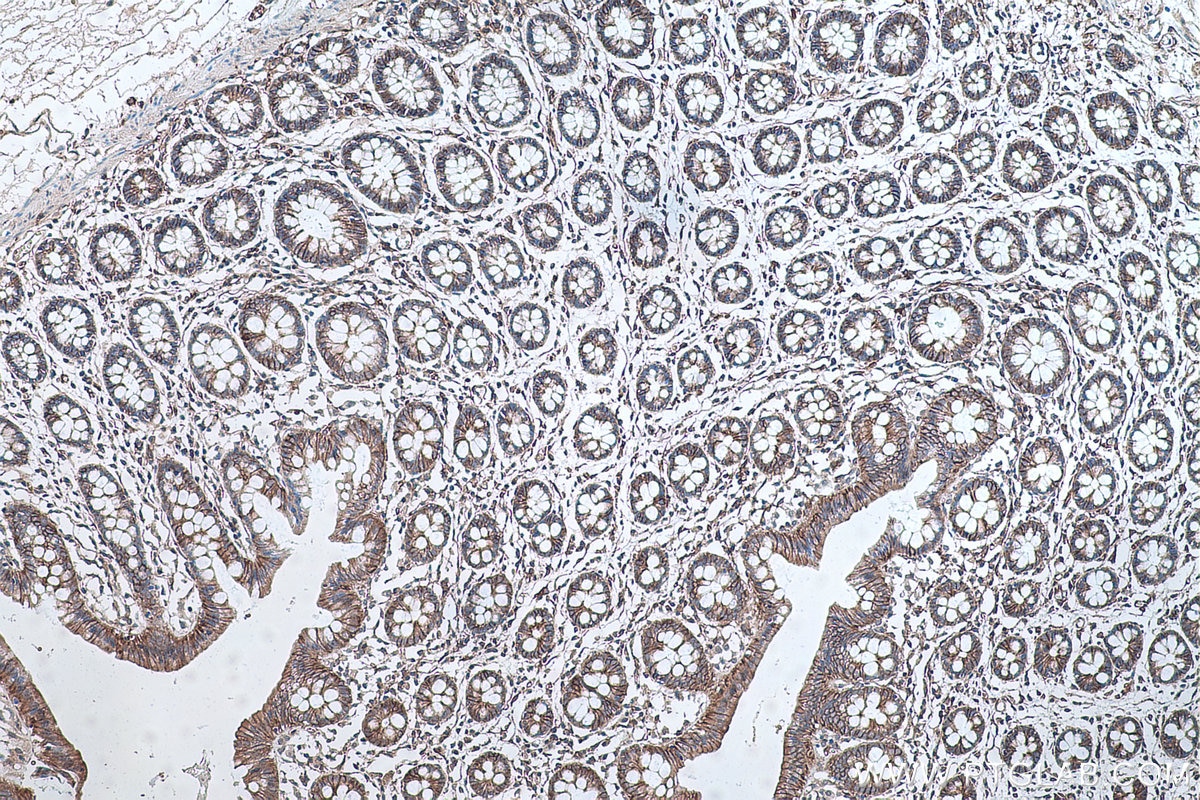 Immunohistochemistry (IHC) staining of human colon tissue using IL-17 Monoclonal antibody (66148-1-Ig)