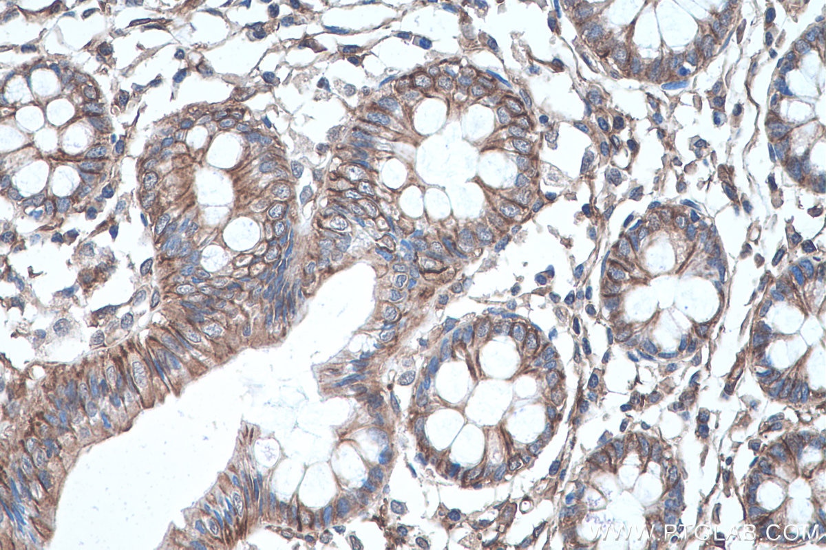 IHC staining of human colon using 66148-1-Ig