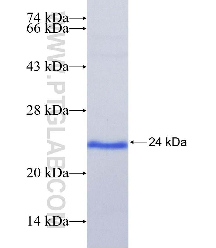 IL-17B fusion protein Ag21453 SDS-PAGE