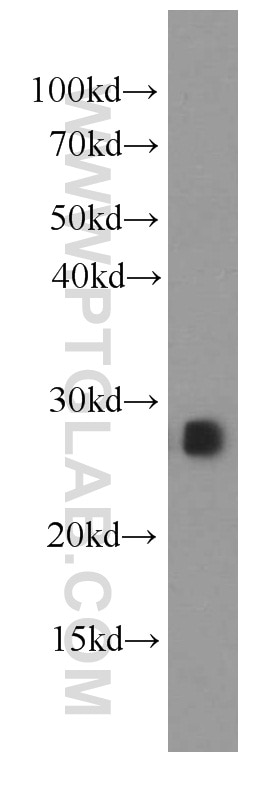 Western Blot (WB) analysis of Recombinant protein using IL-17D Monoclonal antibody (66143-1-Ig)