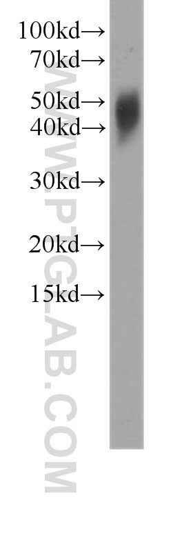 Western Blot (WB) analysis of human brain tissue using IL-17F Monoclonal antibody (60245-1-Ig)