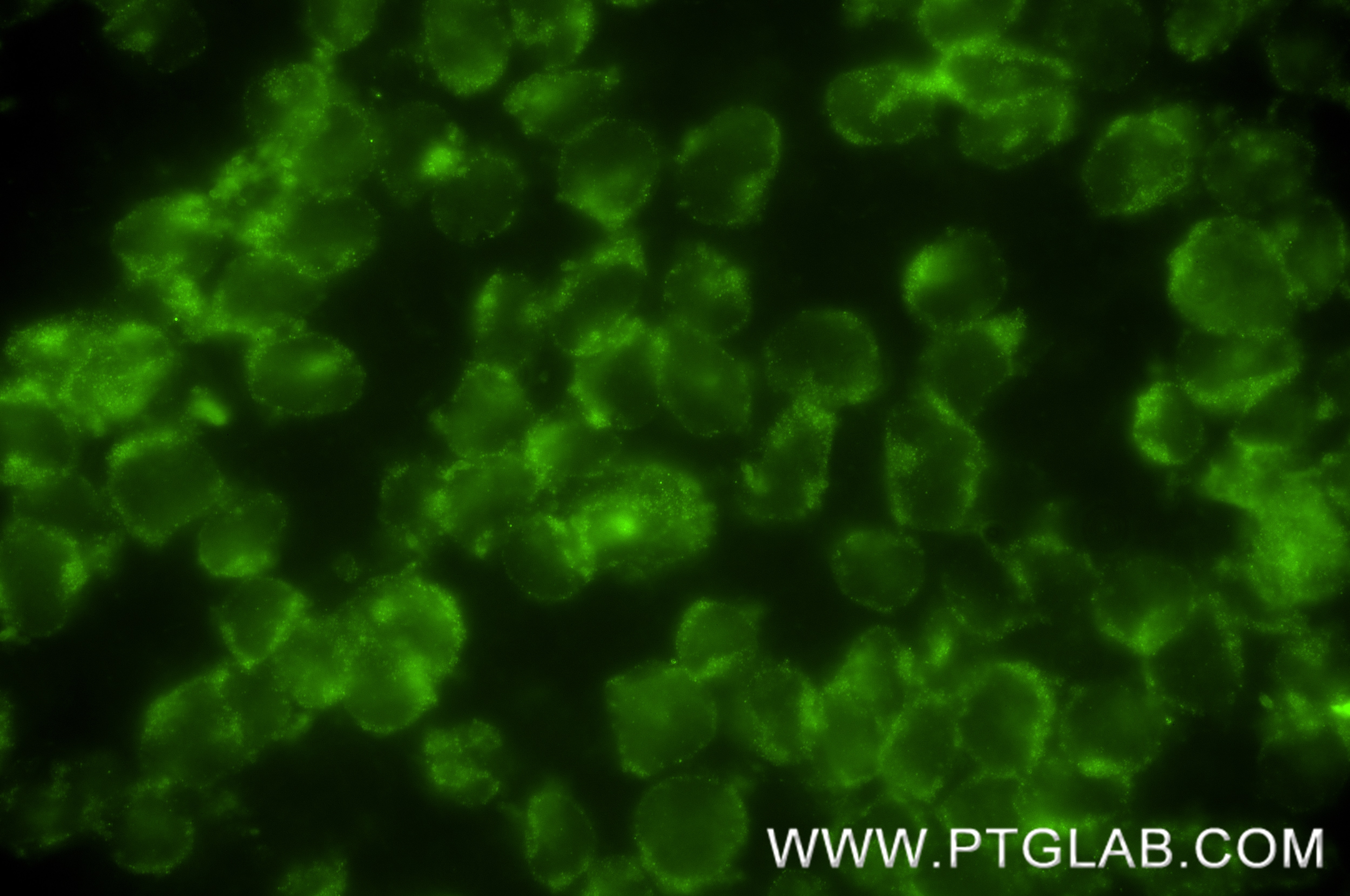 IF Staining of U-937 using 84535-2-RR Immunofluorescence (IF) / fluorescent staining of U-937 cells using IL-17RA Recombinant monoclonal antibody (84535-2-RR)