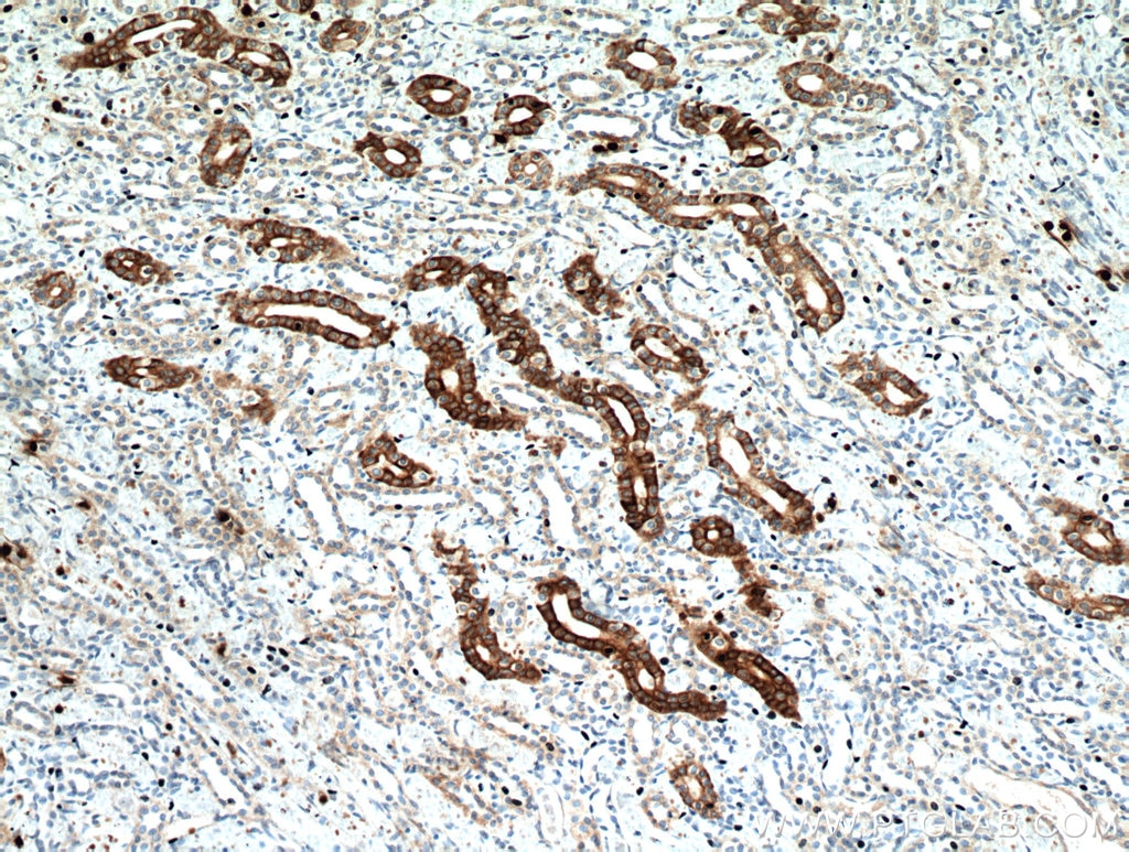 Immunohistochemistry (IHC) staining of human kidney tissue using IL-17RB Polyclonal antibody (20673-1-AP)