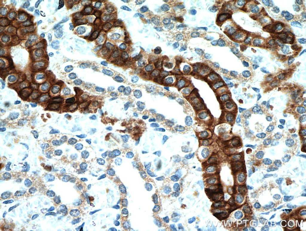 Immunohistochemistry (IHC) staining of human kidney tissue using IL-17RB Polyclonal antibody (20673-1-AP)