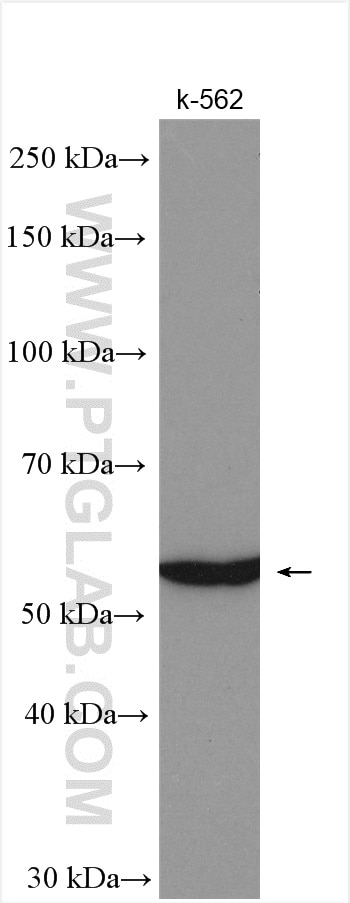 Western Blot (WB) analysis of K-562 cells using IL-17RB Polyclonal antibody (20673-1-AP)