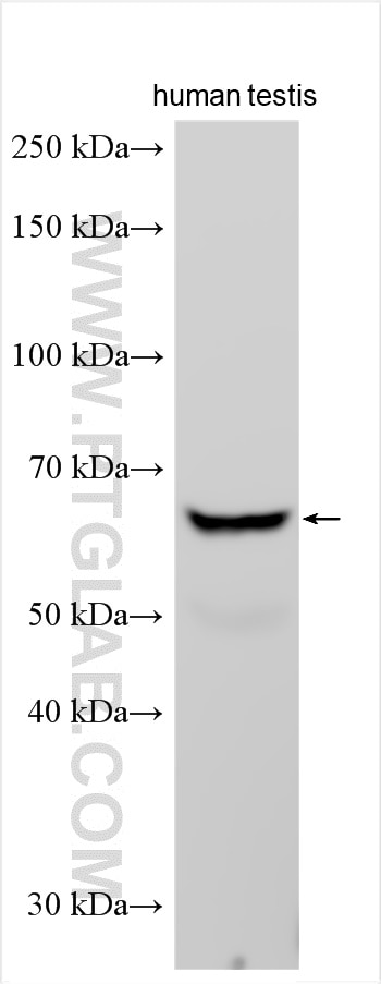 Western Blot (WB) analysis of various lysates using IL-17RB Polyclonal antibody (20673-1-AP)