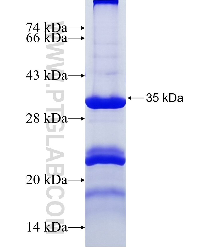 IL17RB fusion protein Ag37458 SDS-PAGE
