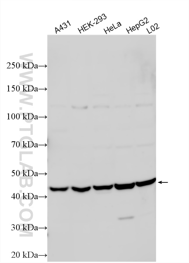 Various lysates were subjected to SDS PAGE followed by western blot with 15648-1-AP (IL-17RC antibody) at dilution of 1:2000 incubated at room temperature for 1.5 hours. Western Blot (WB) analysis of various lysates using IL-17RC Polyclonal antibody (15648-1-AP)
