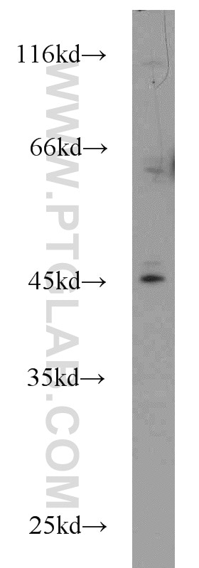 Western Blot (WB) analysis of HepG2 cells using IL-17RC Polyclonal antibody (15648-1-AP)