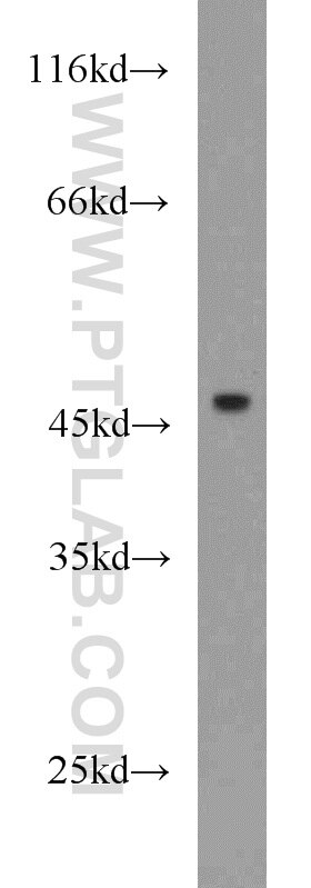 Western Blot (WB) analysis of HEK-293 cells using IL-17RC Polyclonal antibody (15648-1-AP)