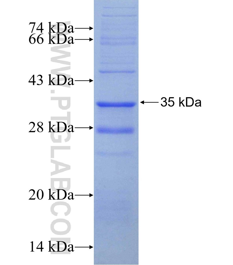 IL17RD fusion protein Ag30102 SDS-PAGE