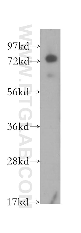 Western Blot (WB) analysis of human kidney tissue using IL-17RE Polyclonal antibody (11984-1-AP)