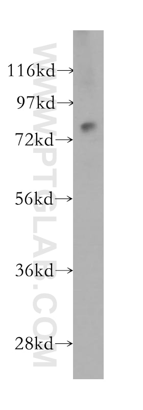 Western Blot (WB) analysis of PC-3 cells using IL-17RE Polyclonal antibody (11984-1-AP)