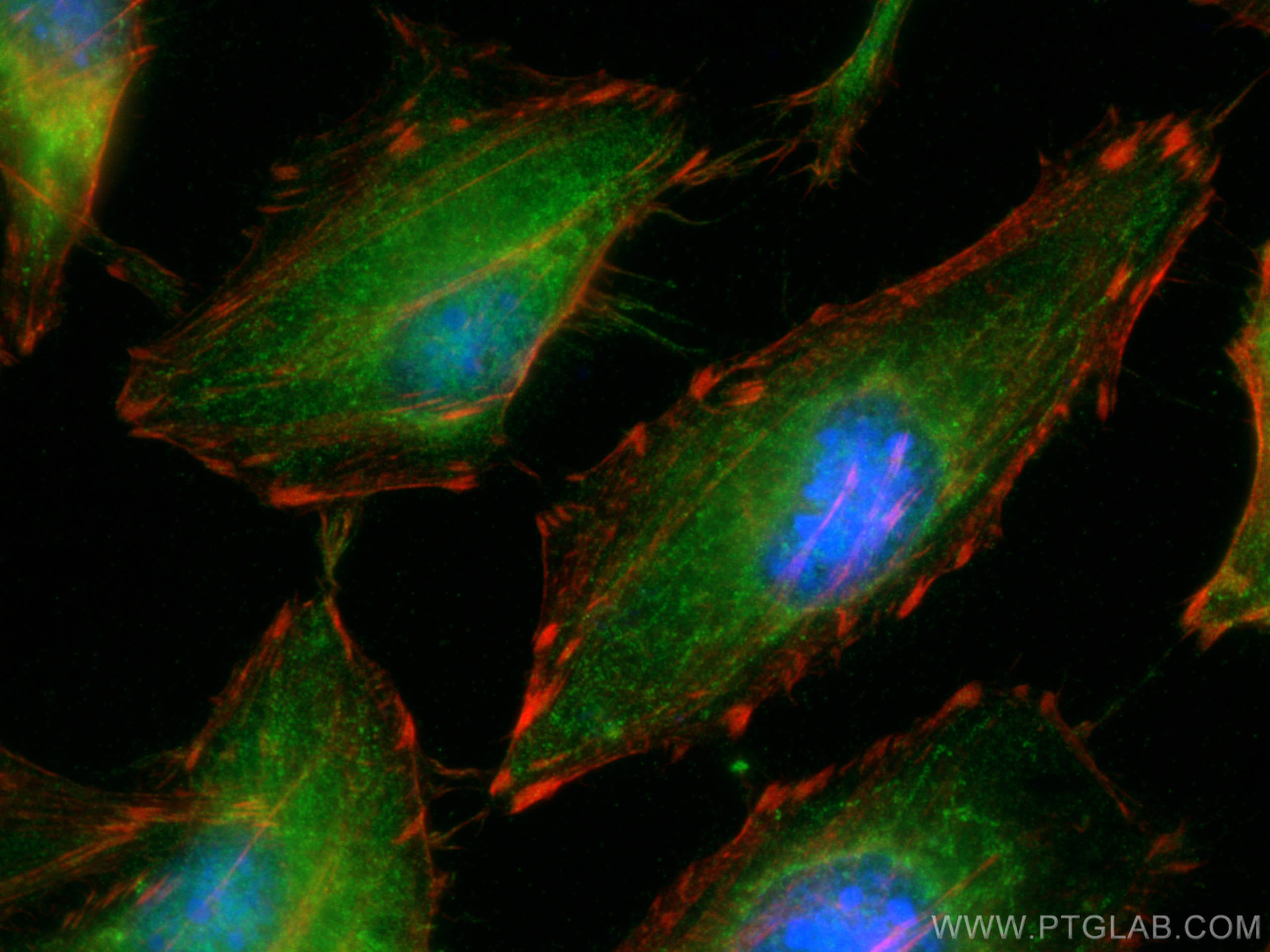 Immunofluorescence (IF) / fluorescent staining of HeLa cells using IL-18 Polyclonal antibody (10663-1-AP)