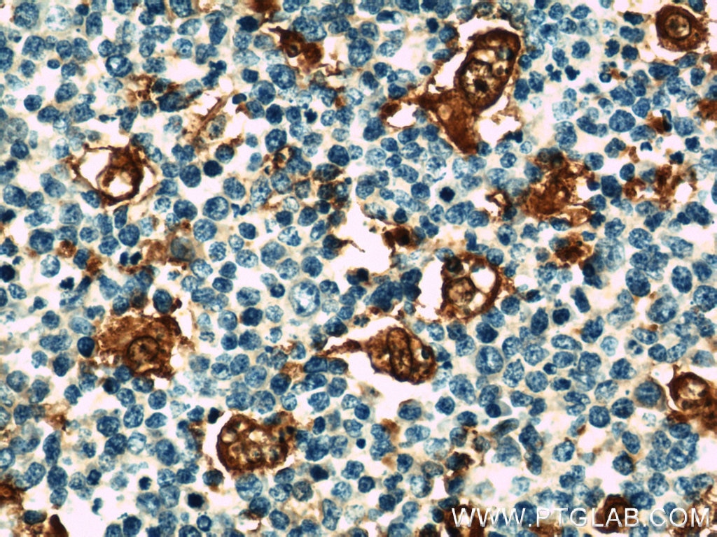 IL-18 Polyclonal antibody