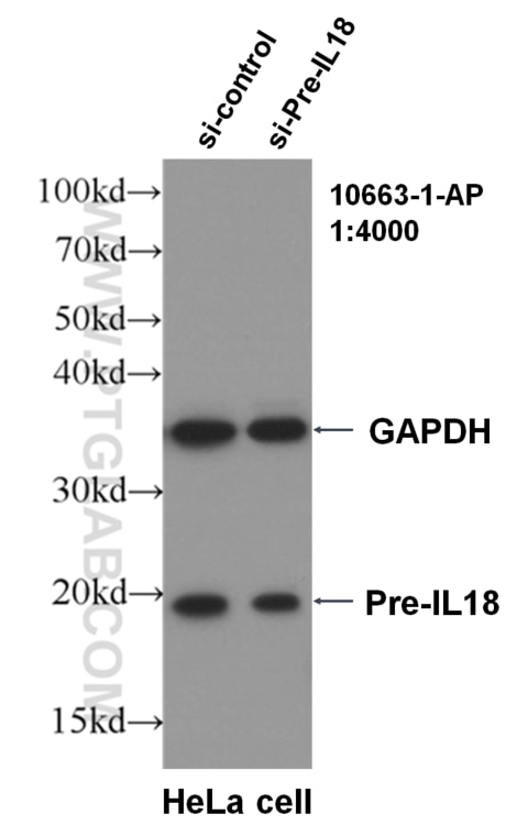 Western Blot (WB) analysis of HeLa cells using IL-18 Polyclonal antibody (10663-1-AP)