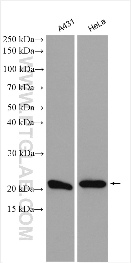 Western Blot (WB) analysis of various lysates using IL-18 Polyclonal antibody (10663-1-AP)