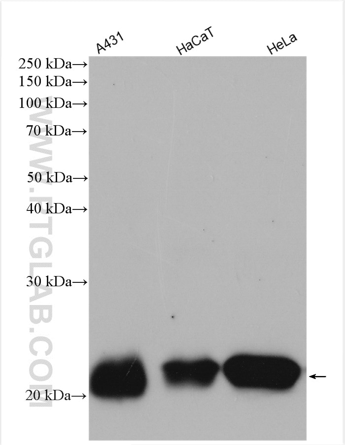 Western Blot (WB) analysis of various lysates using IL-18 Polyclonal antibody (10663-1-AP)