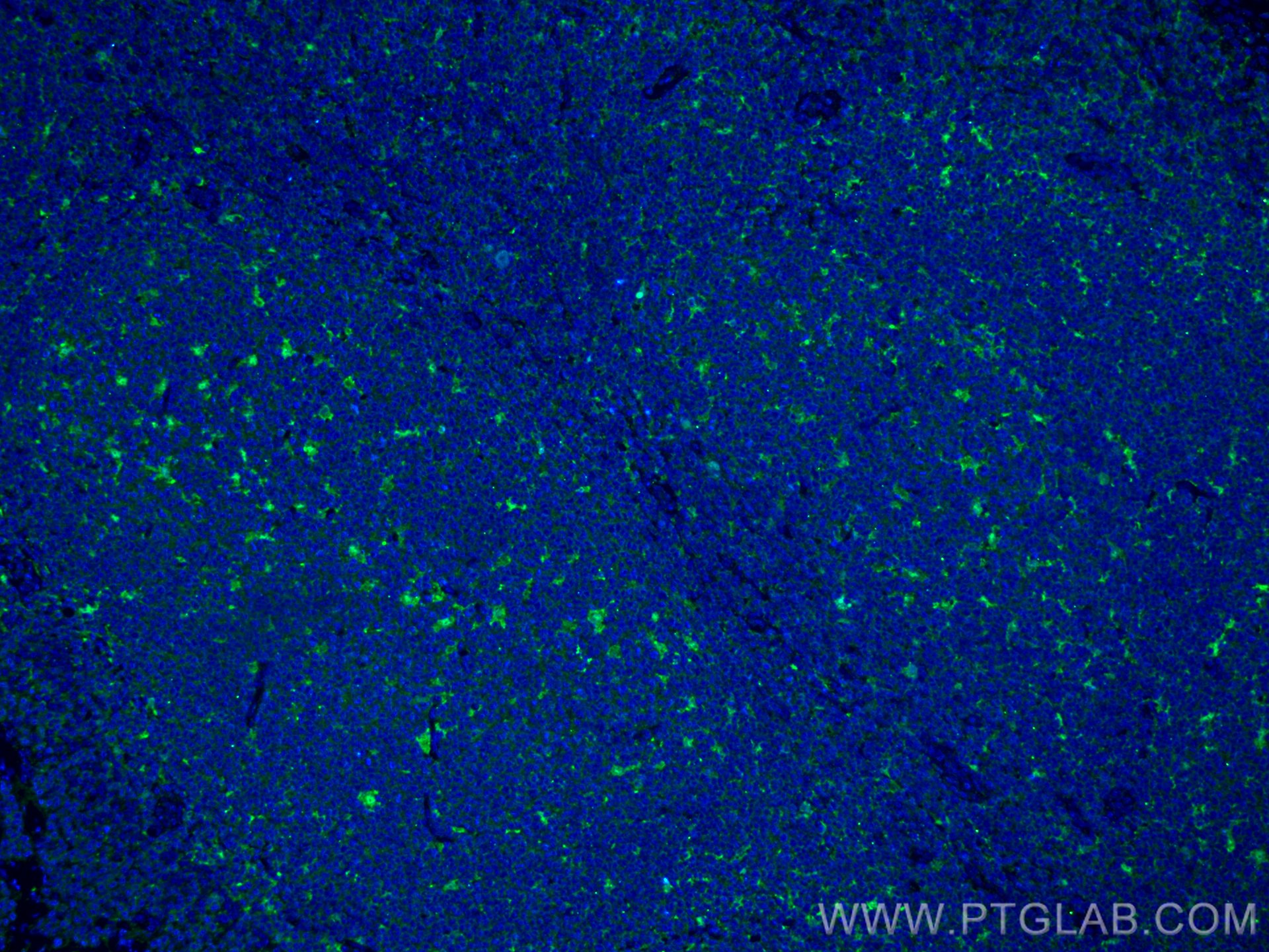 Immunofluorescence (IF) / fluorescent staining of human tonsillitis tissue using IL-18 Monoclonal antibody (60070-1-Ig)