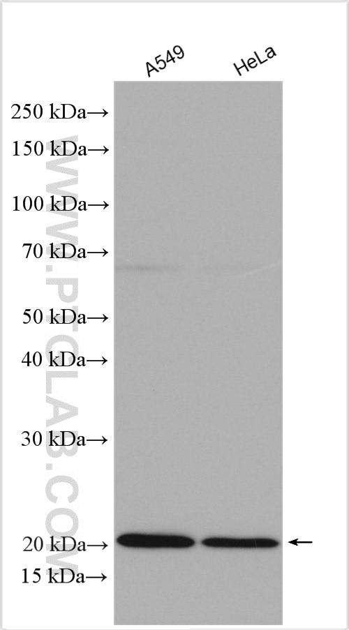 Western Blot (WB) analysis of various lysates using IL-18BP Polyclonal antibody (14153-1-AP)