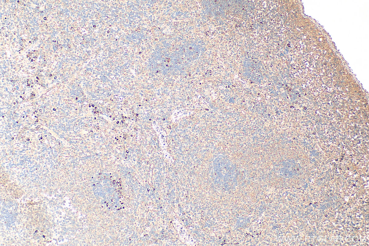 Immunohistochemistry (IHC) staining of rat spleen tissue using IL18RAP Polyclonal antibody (30587-1-AP)