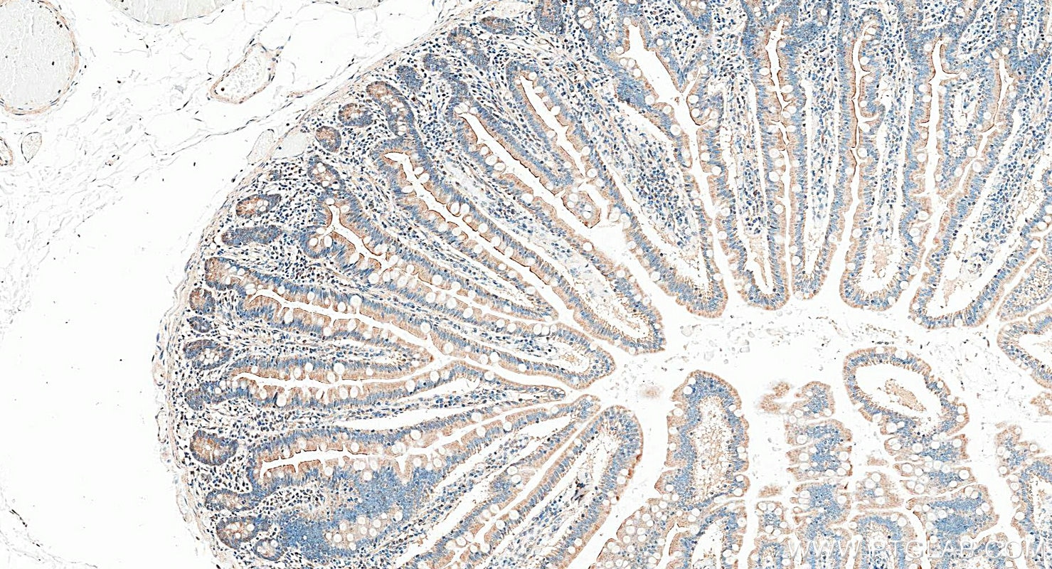 Immunohistochemistry (IHC) staining of human small intestine tissue using IL18RAP Polyclonal antibody (30587-1-AP)