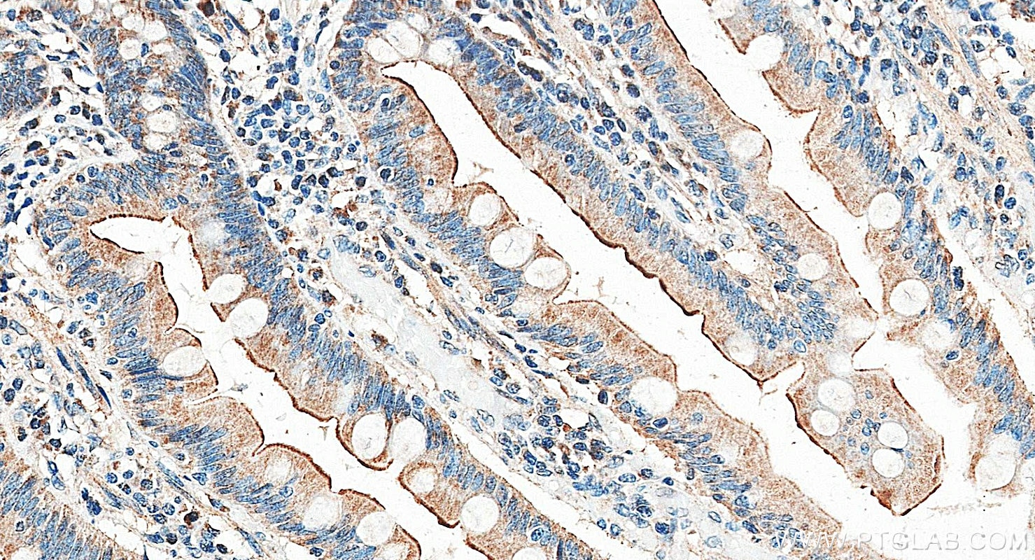 Immunohistochemistry (IHC) staining of human small intestine tissue using IL18RAP Polyclonal antibody (30587-1-AP)