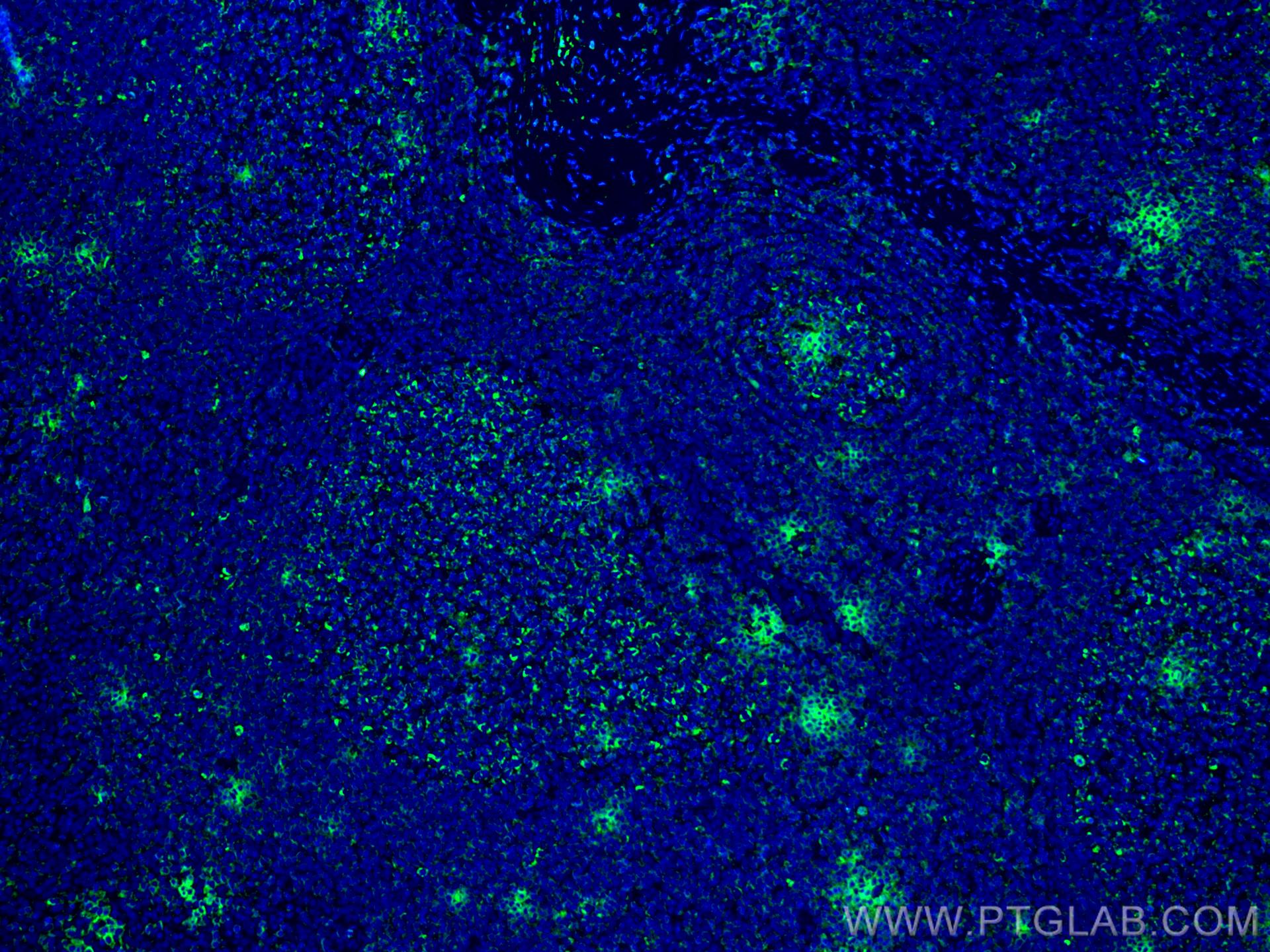 Immunofluorescence (IF) / fluorescent staining of human tonsillitis tissue using IL-19 Monoclonal antibody (60278-1-Ig)