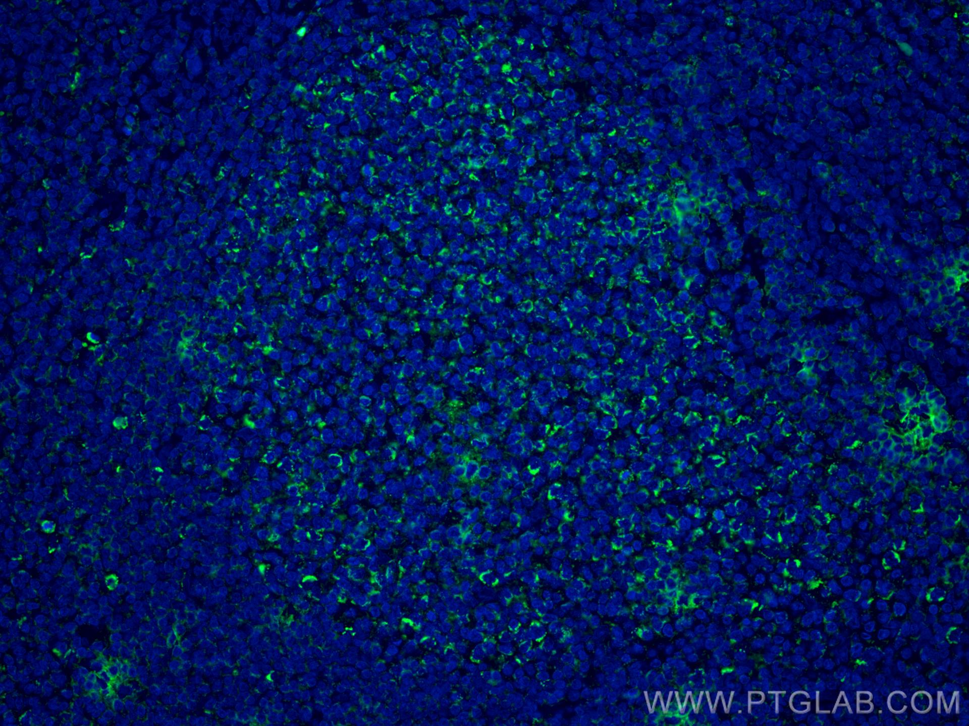 Immunofluorescence (IF) / fluorescent staining of human tonsillitis tissue using IL-19 Monoclonal antibody (60278-1-Ig)