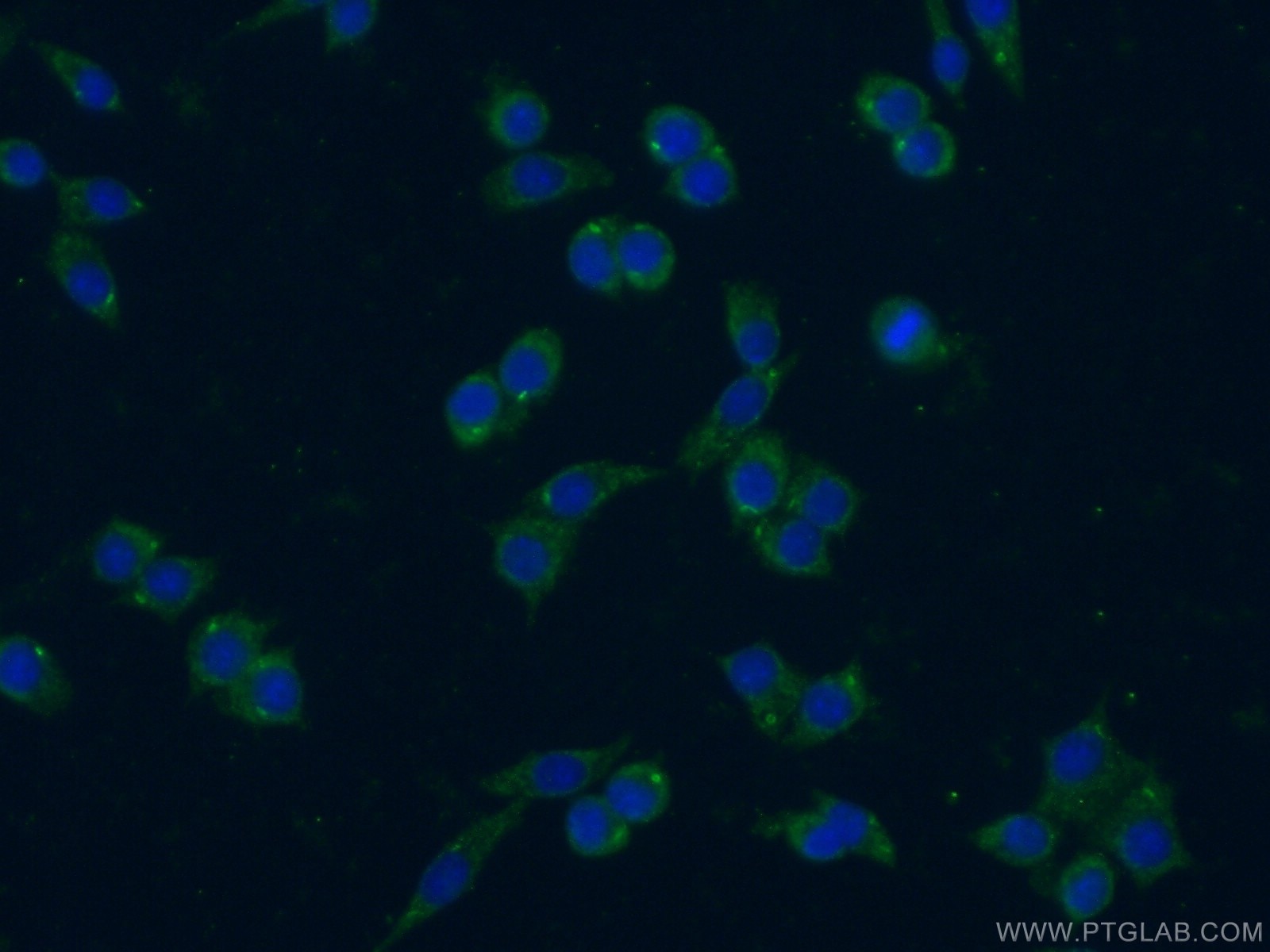 Immunofluorescence (IF) / fluorescent staining of RAW 264.7 cells using IL-1 Alpha Polyclonal antibody (16765-1-AP)