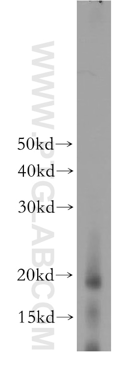 Western Blot (WB) analysis of human placenta tissue using IL-1 Alpha Polyclonal antibody (16765-1-AP)