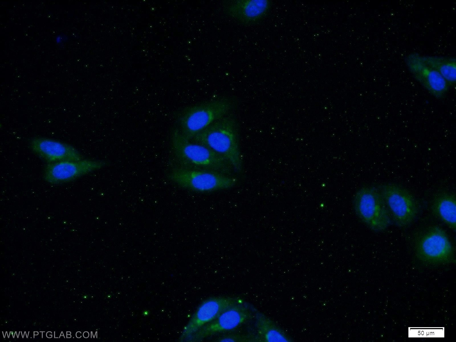 IL-1 Beta Polyclonal antibody