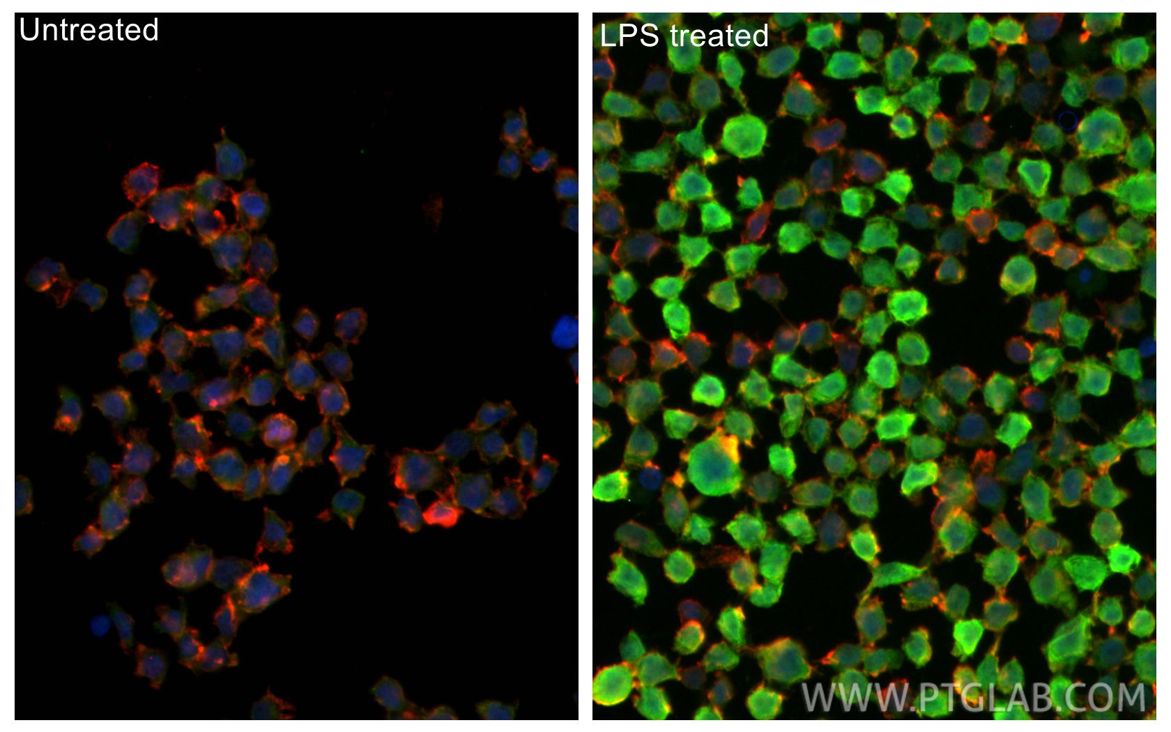 Immunofluorescence (IF) / fluorescent staining of THP-1 cells using IL-1 beta Polyclonal antibody (16806-1-AP)