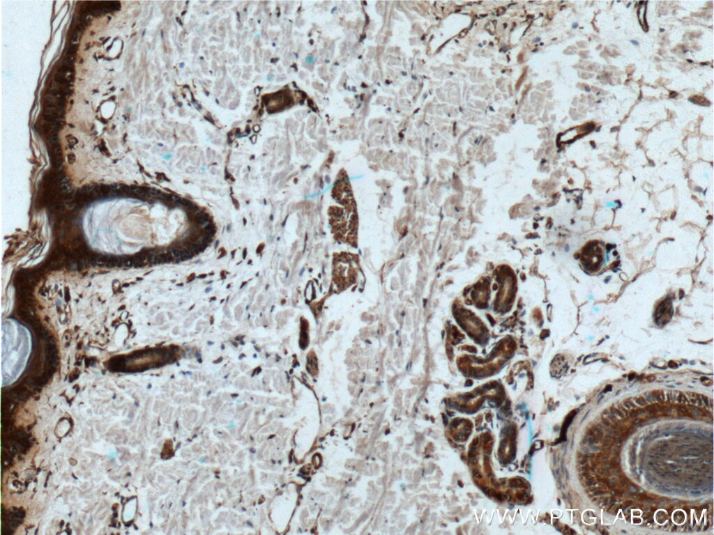 IL-1 Beta Polyclonal antibody