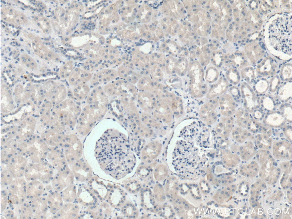 Immunohistochemistry (IHC) staining of human kidney tissue using IL-1 Beta Polyclonal antibody (16806-1-AP)