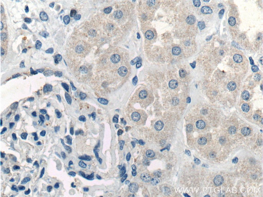 Immunohistochemistry (IHC) staining of human kidney tissue using IL-1 Beta Polyclonal antibody (16806-1-AP)