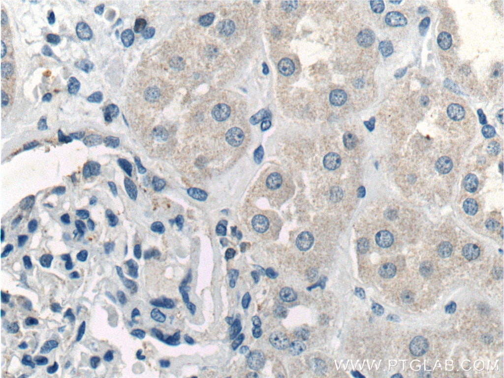 IHC staining of human kidney using 16806-1-AP