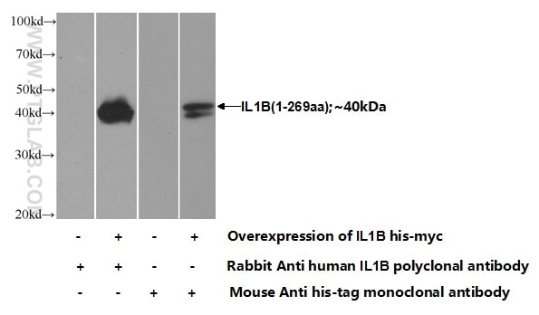 IL-1 Beta Polyclonal antibody