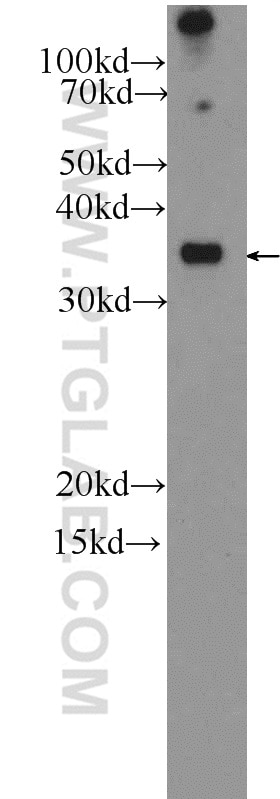 Western Blot (WB) analysis of A431 cells using IL-1 Beta Polyclonal antibody (16806-1-AP)