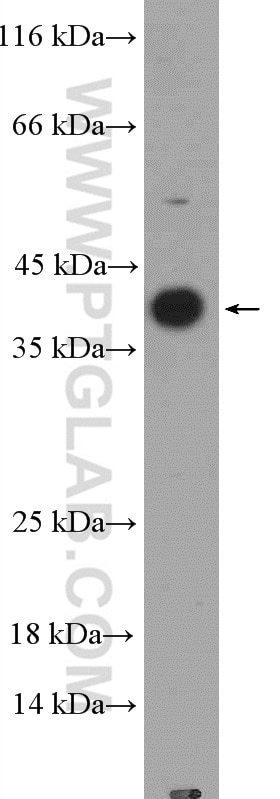 IL-1 Beta Polyclonal antibody