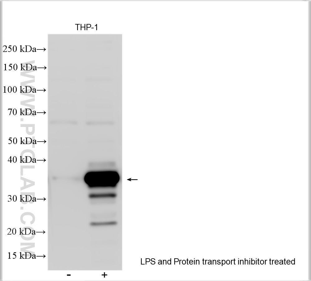 Western Blot (WB) analysis of various lysates using IL-1 Beta Polyclonal antibody (16806-1-AP)