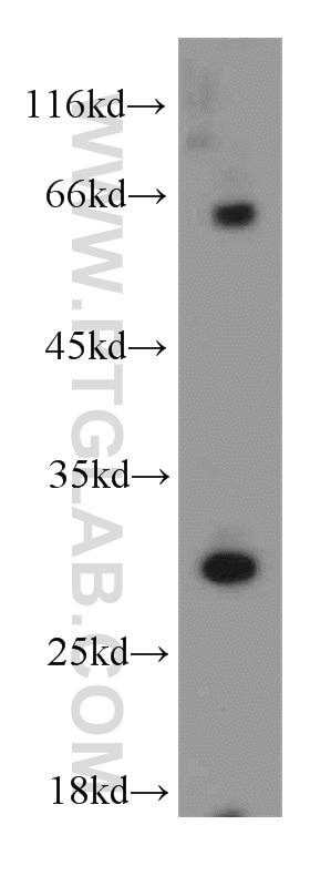 Western Blot (WB) analysis of human adrenal gland tissue using IL-1 Beta Polyclonal antibody (16806-1-AP)