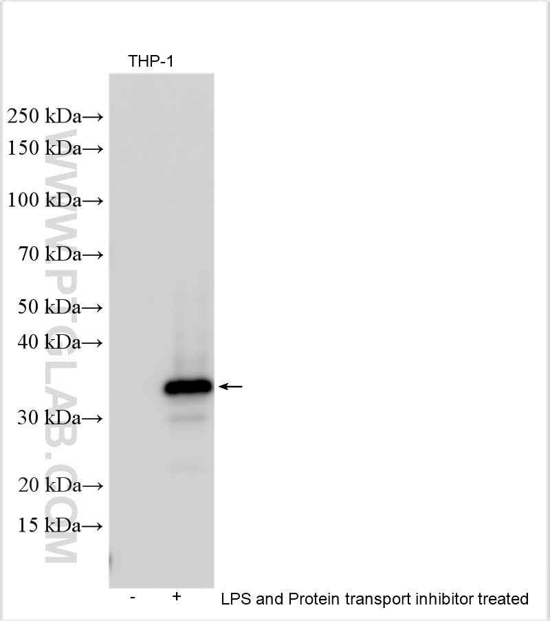 Western Blot (WB) analysis of various lysates using IL-1 beta Polyclonal antibody (30234-1-AP)