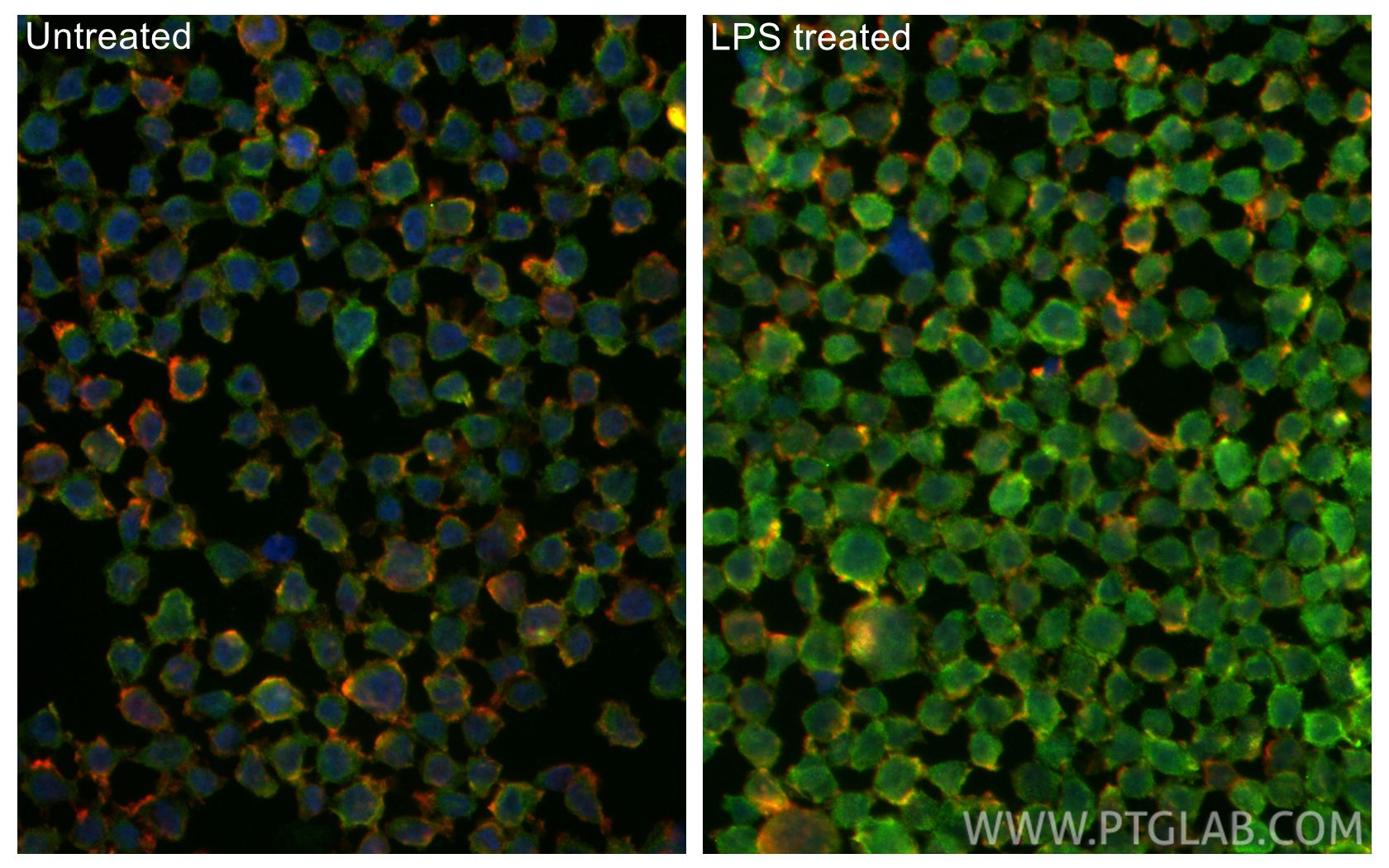Immunofluorescence (IF) / fluorescent staining of THP-1 cells using IL-1 beta Recombinant antibody (82696-6-RR)