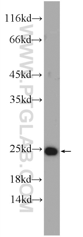 Western Blot (WB) analysis of Recombinant protein using IL-1F10 Polyclonal antibody (21530-1-AP)