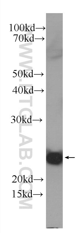 Western Blot (WB) analysis of Recombinant protein using IL-1F10 Monoclonal antibody (60319-1-Ig)