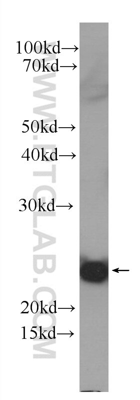 WB analysis of Recombinant protein using 60319-1-Ig