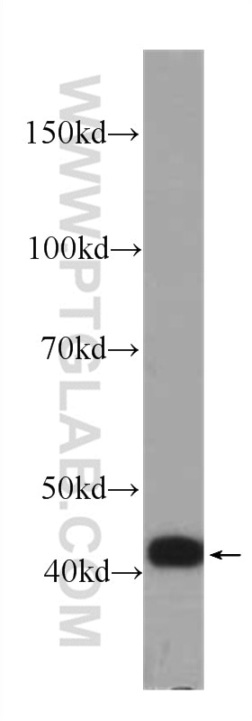 Western Blot (WB) analysis of Recombinant protein using IL-36RN Monoclonal antibody (60298-1-Ig)