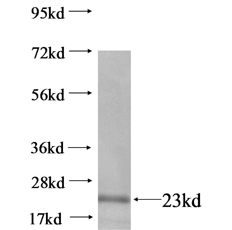 IL-1F5 fusion protein Ag14658 SDS-PAGE