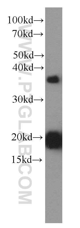 Western Blot (WB) analysis of Recombinant protein using IL-1F6 / IL-36α Monoclonal antibody (66147-1-Ig)